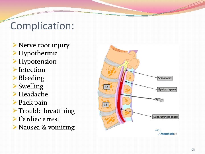 Complication: Ø Nerve root injury Ø Hypothermia Ø Hypotension Ø Infection Ø Bleeding Ø