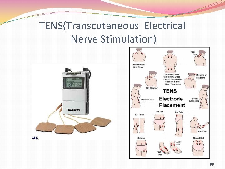 TENS(Transcutaneous Electrical Nerve Stimulation) 99 