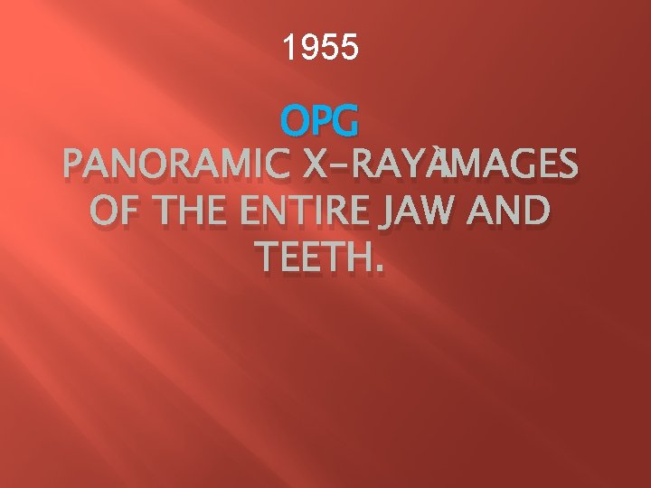 1955 OPG PANORAMIC X-RAY IMAGES OF THE ENTIRE JAW AND TEETH. 1955 OPG PANORAMIC X-RAY IMAGES OF THE ENTIRE JAW AND TEETH.