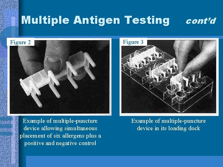 Multiple Antigen Testing Figure 2 Example of multiple-puncture device allowing simultaneous placement of six