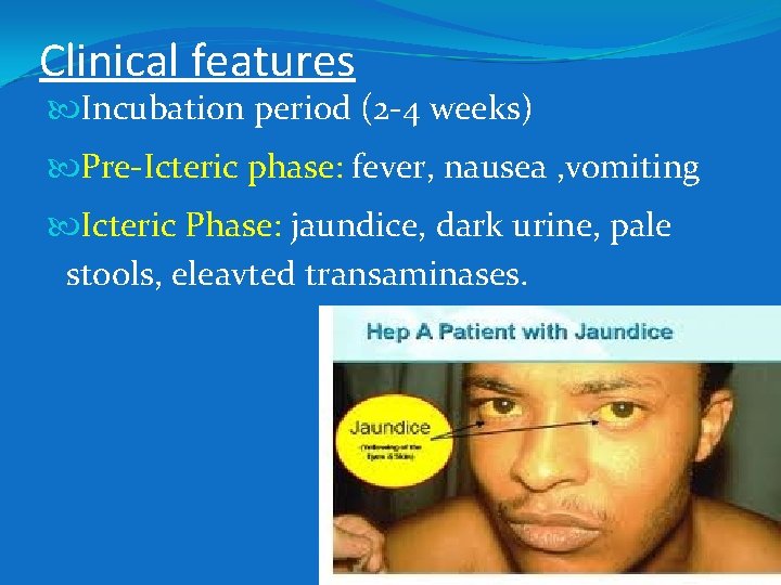 Clinical features Incubation period (2 -4 weeks) Pre-Icteric phase: fever, nausea , vomiting Icteric