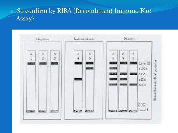  So confirm by RIBA (Recombinant Immuno Blot Assay) 