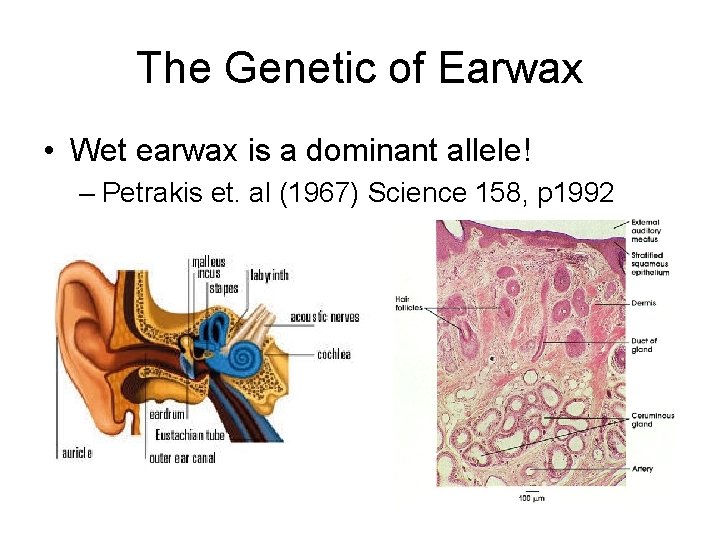 The Genetic of Earwax • Wet earwax is a dominant allele! – Petrakis et.