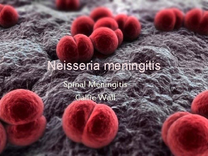 Neisseria meningitis Spinal Meningitis Callie Wall 