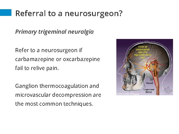 Referral to a neurosurgeon? Primary trigeminal neuralgia Refer to a neurosurgeon if carbamazepine or