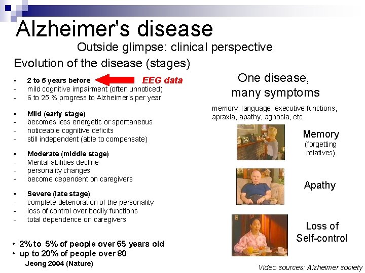 Alzheimer's disease Outside glimpse: clinical perspective Evolution of the disease (stages) One disease, •