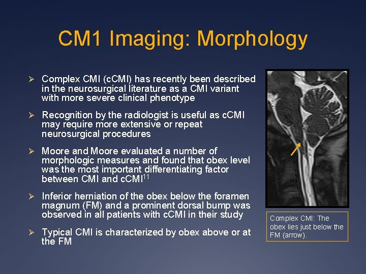 CM 1 Imaging: Morphology Ø Complex CMI (c. CMI) has recently been described in