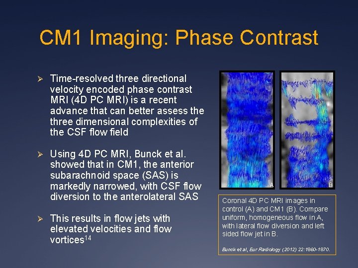 CM 1 Imaging: Phase Contrast Ø Time-resolved three directional velocity encoded phase contrast MRI