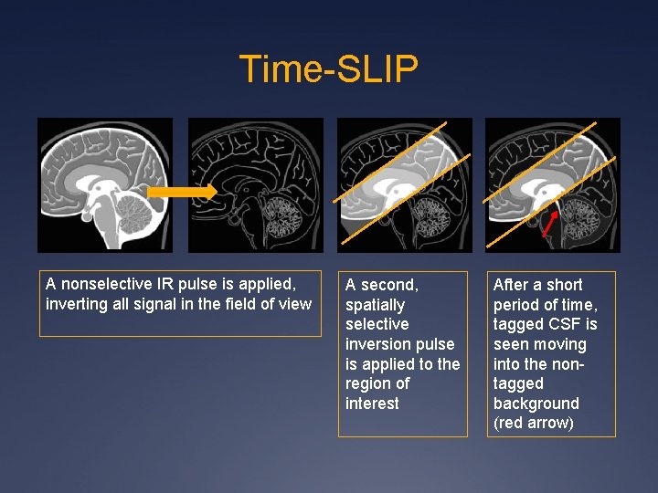 Time-SLIP A nonselective IR pulse is applied, inverting all signal in the field of