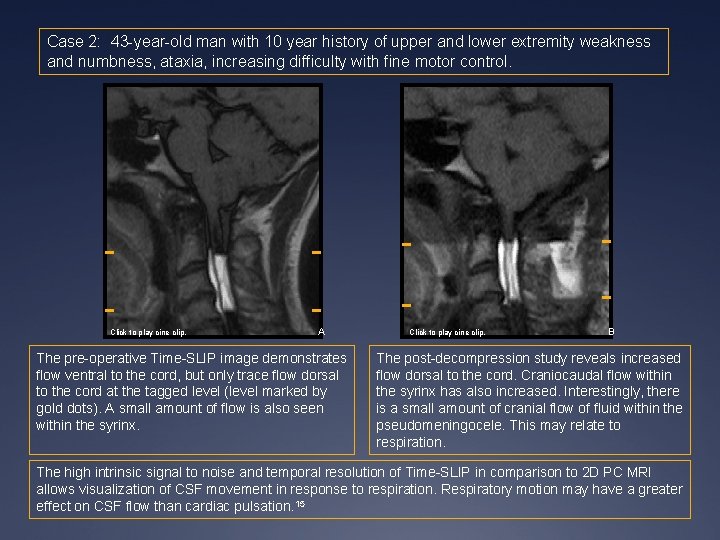 Case 2: 43 -year-old man with 10 year history of upper and lower extremity