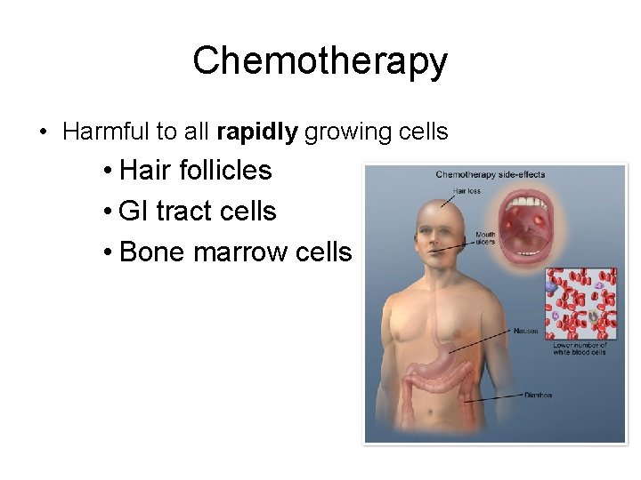 Chemotherapy • Harmful to all rapidly growing cells • Hair follicles • GI tract