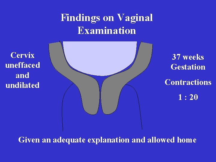 Findings on Vaginal Examination Cervix uneffaced and undilated 37 weeks Gestation Contractions 1 : Findings on Vaginal Examination Cervix uneffaced and undilated 37 weeks Gestation Contractions 1 :