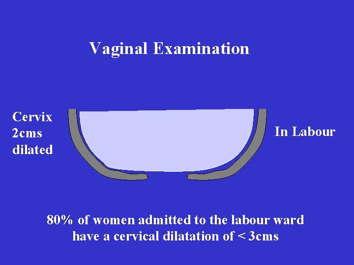 Vaginal Examination Cervix 2 cms dilated In Labour 80% of women admitted to the