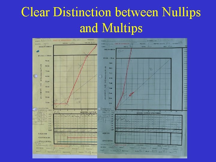 Clear Distinction between Nullips and Multips gl 