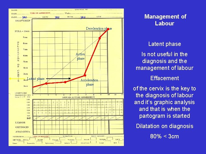 yes yes Deceleration phase Management of Labour Latent phase Active phase Latent phase Acceleration