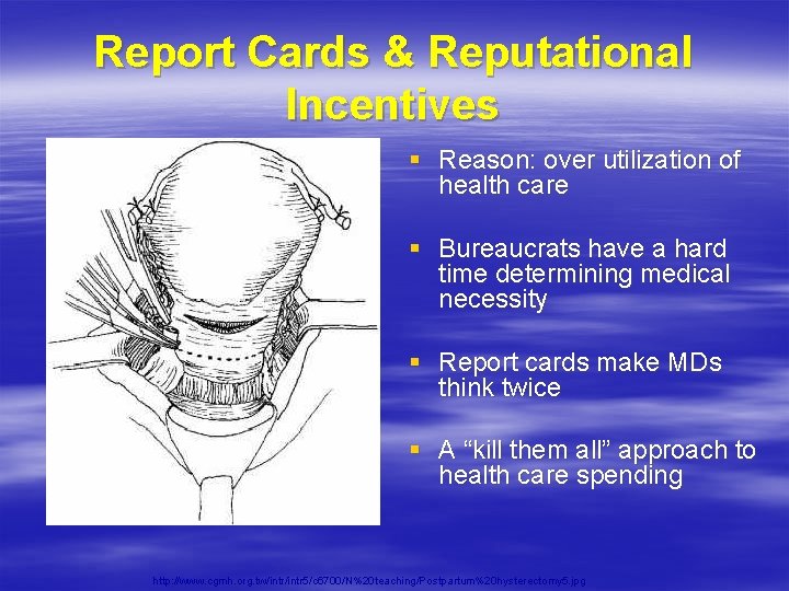 Report Cards & Reputational Incentives § Reason: over utilization of health care § Bureaucrats Report Cards & Reputational Incentives § Reason: over utilization of health care § Bureaucrats