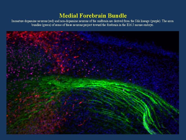 Medial Forebrain Bundle Immature dopamine neurons (red) and non-dopamine neurons of the midbrain are