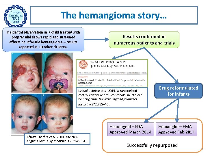 The hemangioma story… Incidental observation in a child treated with propranolol shows rapid and