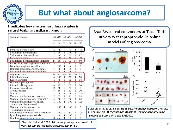 But what about angiosarcoma? Investigators look at expression of beta receptors in range of
