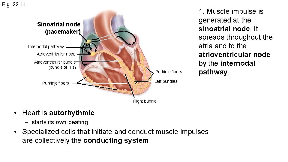 Fig. 22. 11 Sinoatrial node (pacemaker) Internodal pathway Atrioventricular node Atrioventricular bundle (bundle of