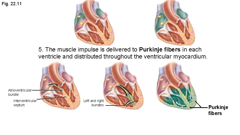 Fig. 22. 11 5. The muscle impulse is delivered to Purkinje fibers in each