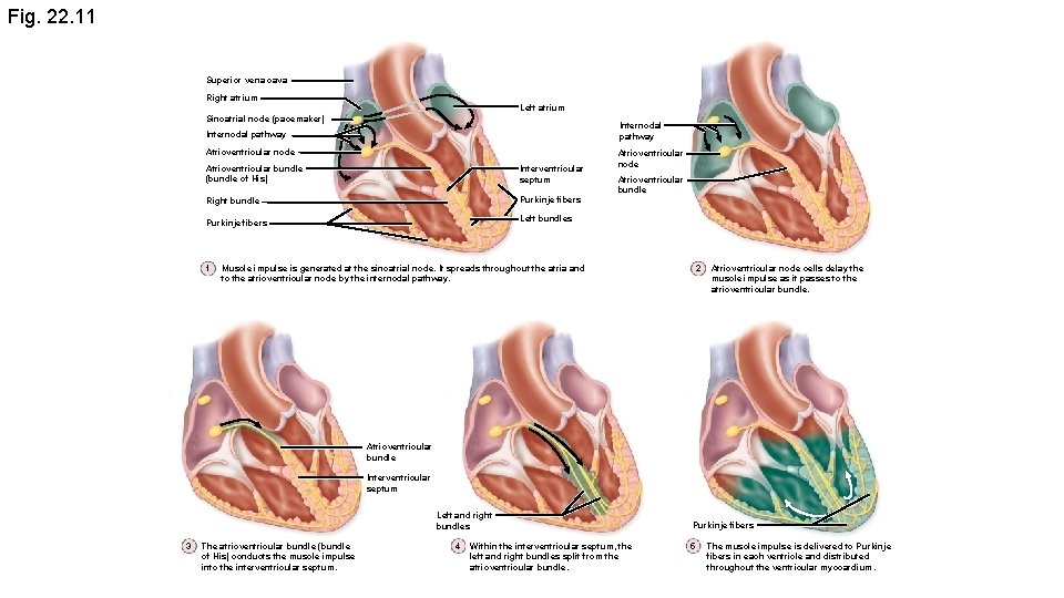 Fig. 22. 11 Superior vena cava Right atrium Left atrium Sinoatrial node (pacemaker) Internodal