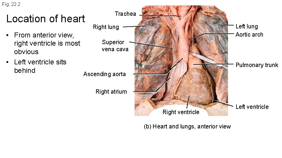 Fig. 22. 2 Location of heart Trachea Left lung Aortic arch Right lung •