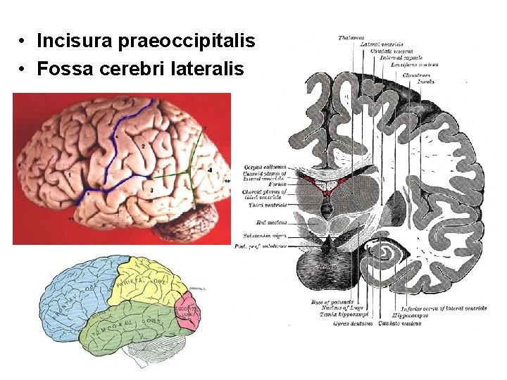  • Incisura praeoccipitalis • Fossa cerebri lateralis 