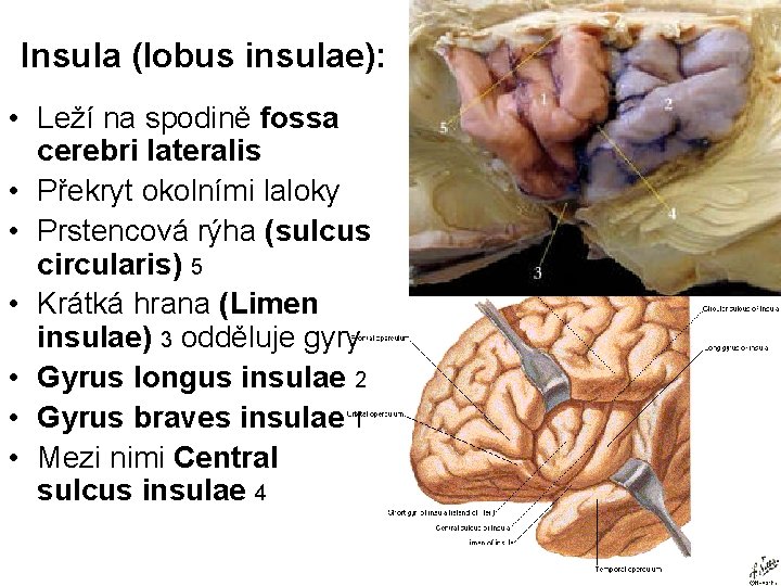 Insula (lobus insulae): • Leží na spodině fossa cerebri lateralis • Překryt okolními laloky