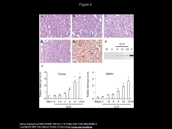 Figure 4 Kidney International 2003 641620 -1631 DOI: (10. 1046/j. 1523 -1755. 2003. 00268.