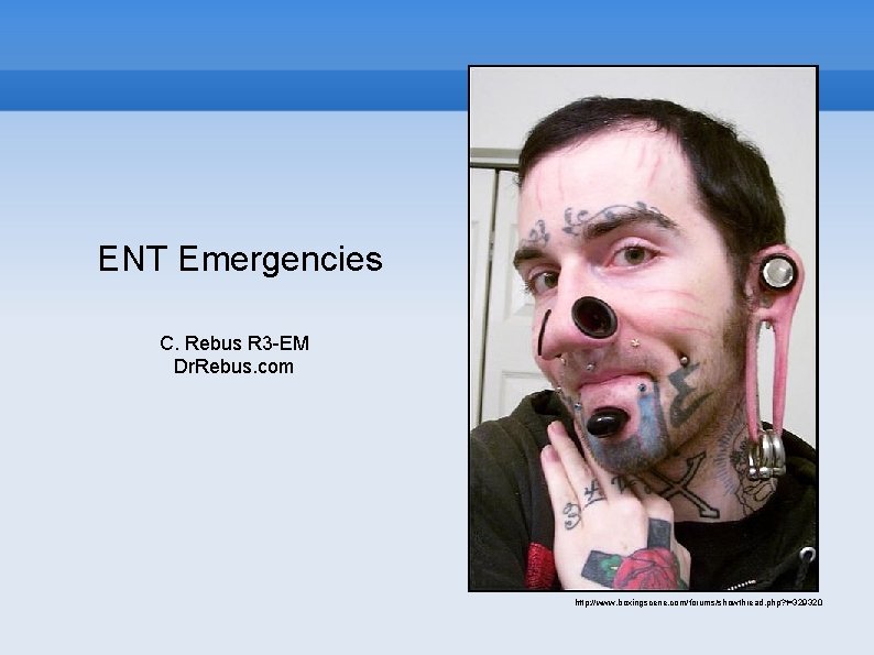 ENT Emergencies C. Rebus R 3 -EM Dr. Rebus. com http: //www. boxingscene. com/forums/showthread.