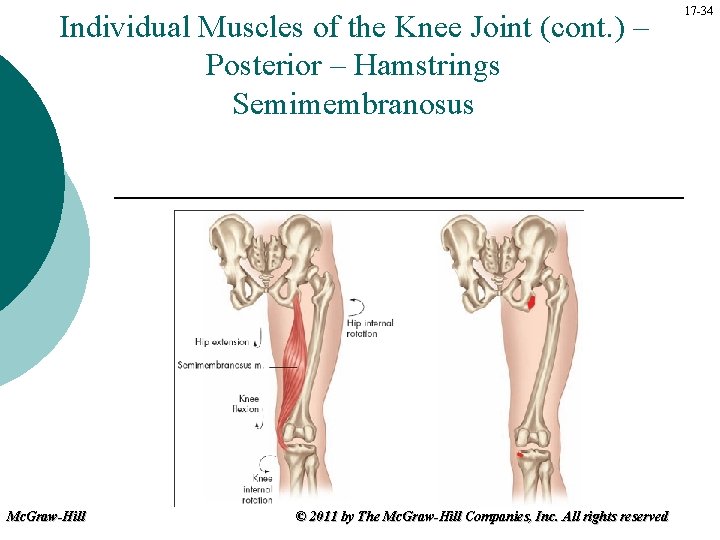 Individual Muscles of the Knee Joint (cont. ) – Posterior – Hamstrings Semimembranosus Mc.