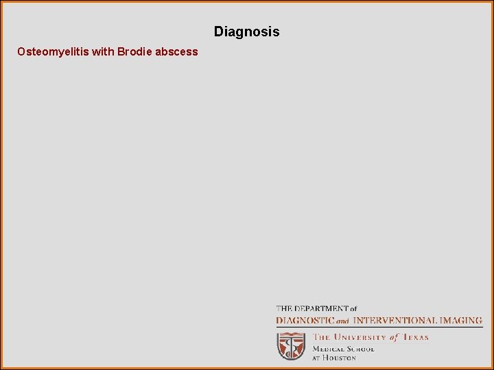 Diagnosis Osteomyelitis with Brodie abscess 