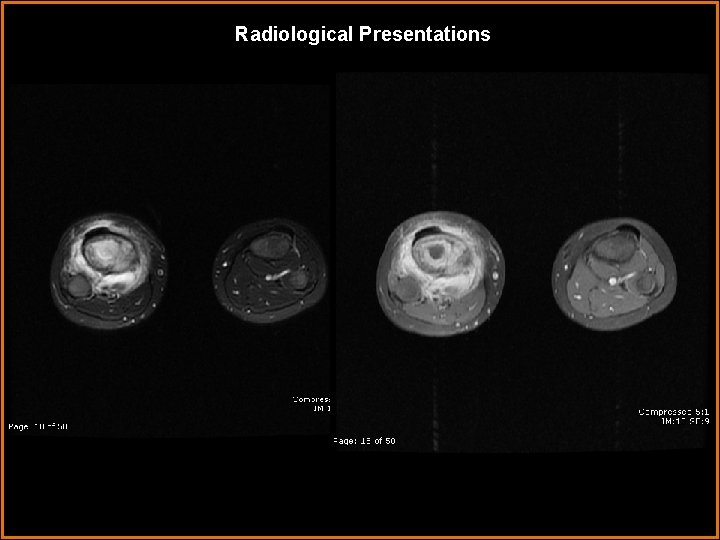 Radiological Presentations 