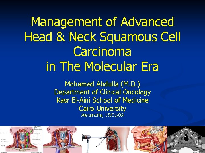 Management of Advanced Head & Neck Squamous Cell Carcinoma in The Molecular Era Mohamed