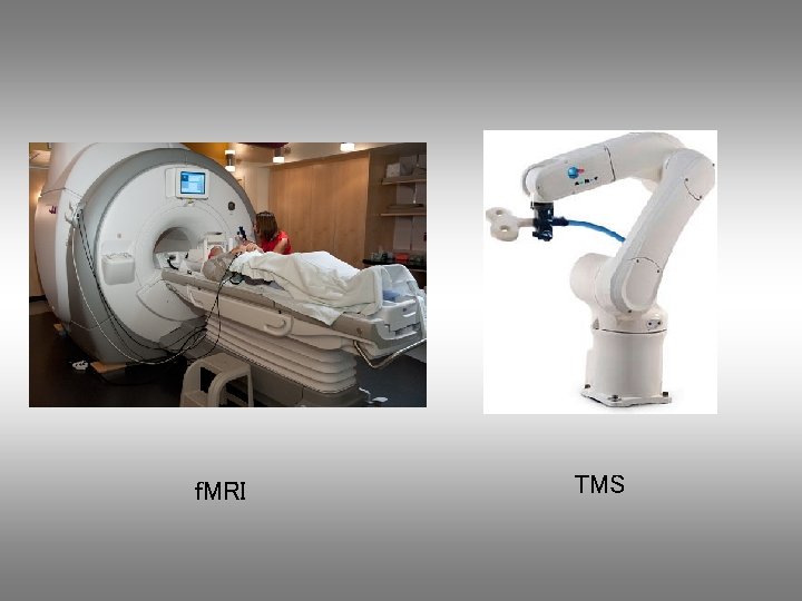 f. MRI TMS 