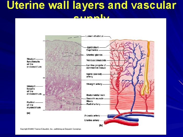 Uterine wall layers and vascular supply Uterine wall layers and vascular supply