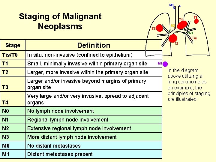 Staging of Malignant Neoplasms Stage Definition Tis/T 0 In situ, non-invasive (confined to epithelium)