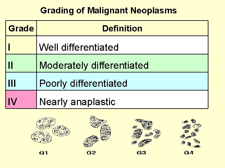 Grading of Malignant Neoplasms Grade Definition I Well differentiated II Moderately differentiated III Poorly