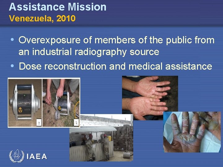 Assistance Mission Venezuela, 2010 • Overexposure of members of the public from an industrial