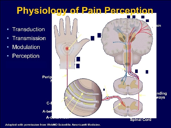 Overview of Pain Perception Overview of Pain Perception