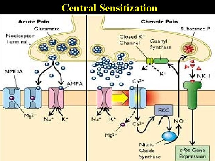 Central Sensitization Central Sensitization