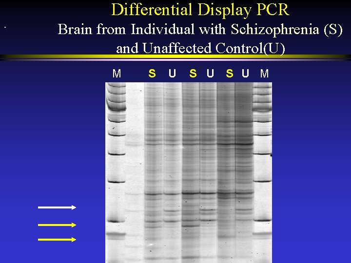 Differential Display PCR Brain from Individual with Schizophrenia (S) and Unaffected Control(U) M S