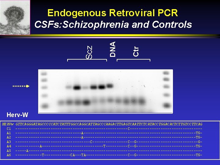 Ctr DNA Scz Endogenous Retroviral PCR CSFs: Schizophrenia and Controls Herv-W HERVw C 1