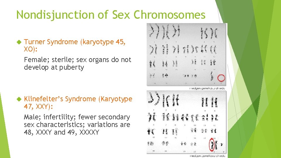 Nondisjunction of Sex Chromosomes Turner Syndrome (karyotype 45, XO): Female; sterile; sex organs do