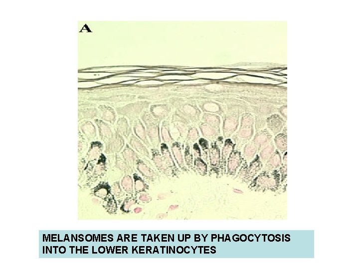 MELANSOMES ARE TAKEN UP BY PHAGOCYTOSIS INTO THE LOWER KERATINOCYTES MELANSOMES ARE TAKEN UP BY PHAGOCYTOSIS INTO THE LOWER KERATINOCYTES