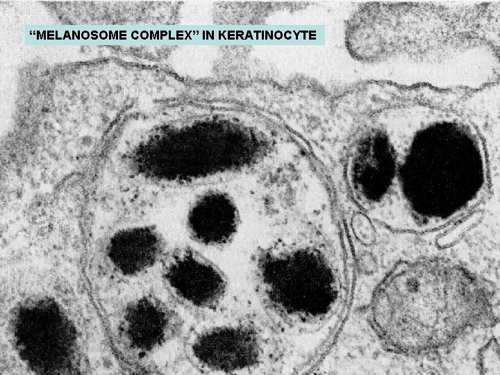 “MELANOSOME COMPLEX” IN KERATINOCYTE “MELANOSOME COMPLEX” IN KERATINOCYTE