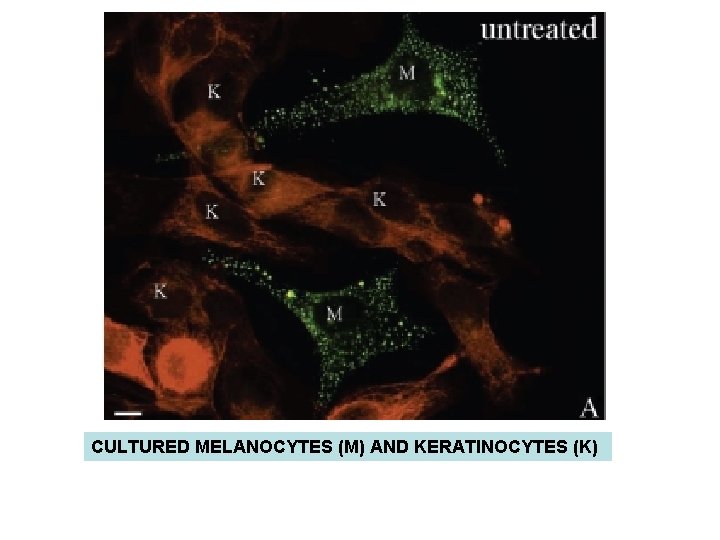 CULTURED MELANOCYTES (M) AND KERATINOCYTES (K) CULTURED MELANOCYTES (M) AND KERATINOCYTES (K)