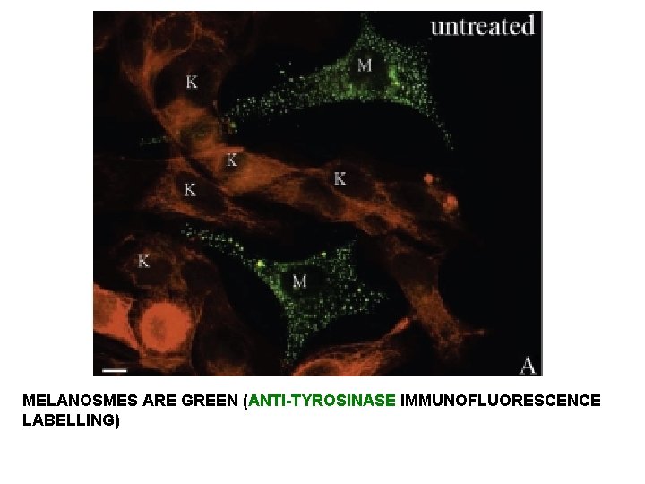MELANOSMES ARE GREEN (ANTI-TYROSINASE IMMUNOFLUORESCENCE LABELLING) MELANOSMES ARE GREEN (ANTI-TYROSINASE IMMUNOFLUORESCENCE LABELLING)