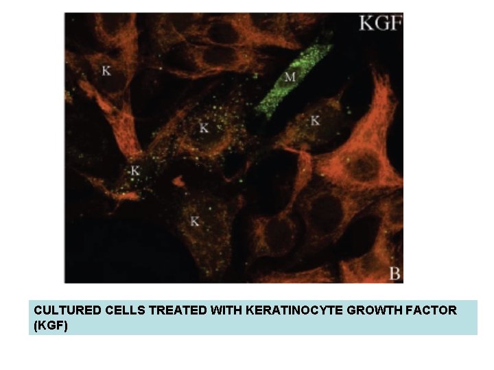 CULTURED CELLS TREATED WITH KERATINOCYTE GROWTH FACTOR (KGF) CULTURED CELLS TREATED WITH KERATINOCYTE GROWTH FACTOR (KGF)
